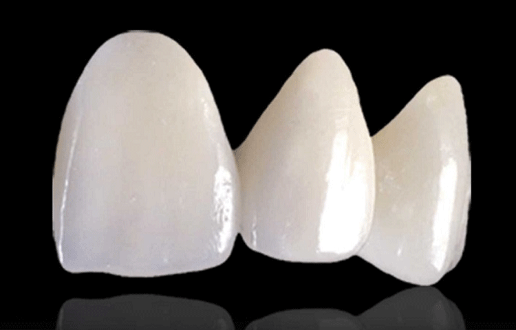 審美歯科・ホワイトニング