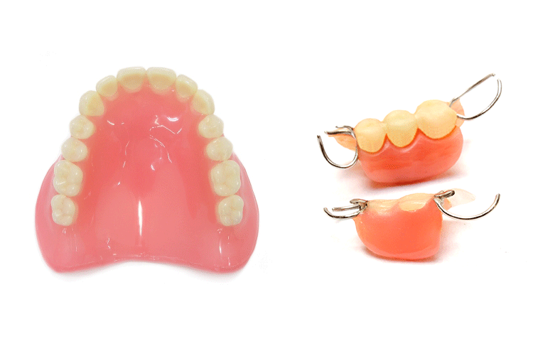 インプラントとは